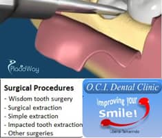 Slider image (3) Dental Clinic OCI Tamarindo